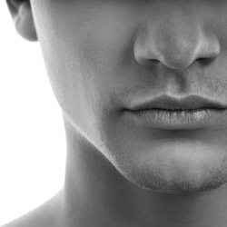 Chin Augmentation with Implant Gallery