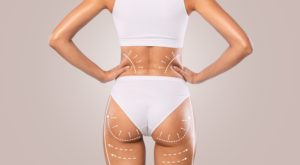 A BBL is a popular procedure to achieve a larger butt and can be an expensive investment for the entire procedure.