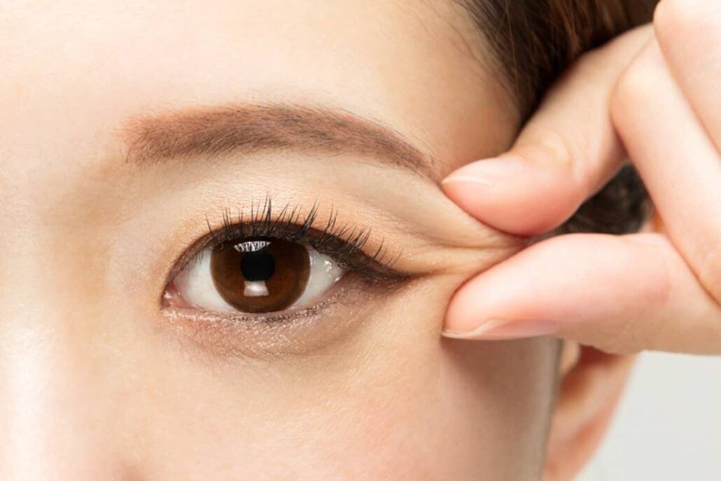 Blepharoplasty is usually recommended for those looking to address issues like droopy eyelids or puffiness under the eyes.