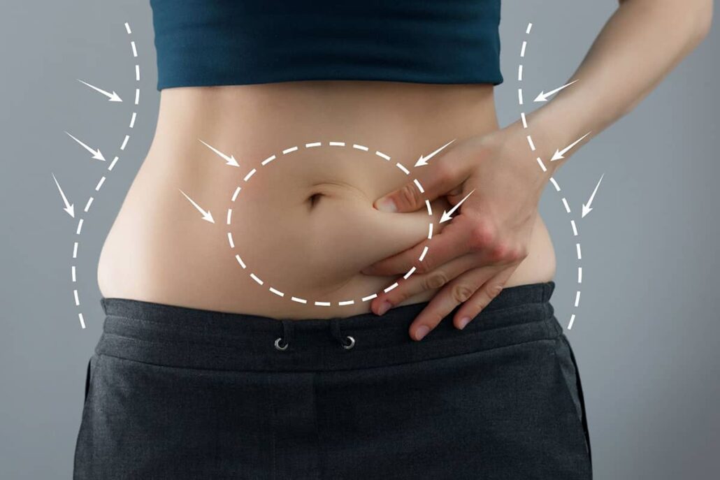 Ideal candidates for an abdominoplasty include those with significant amounts of loose skin or weakened abdominal muscles around the abdomen