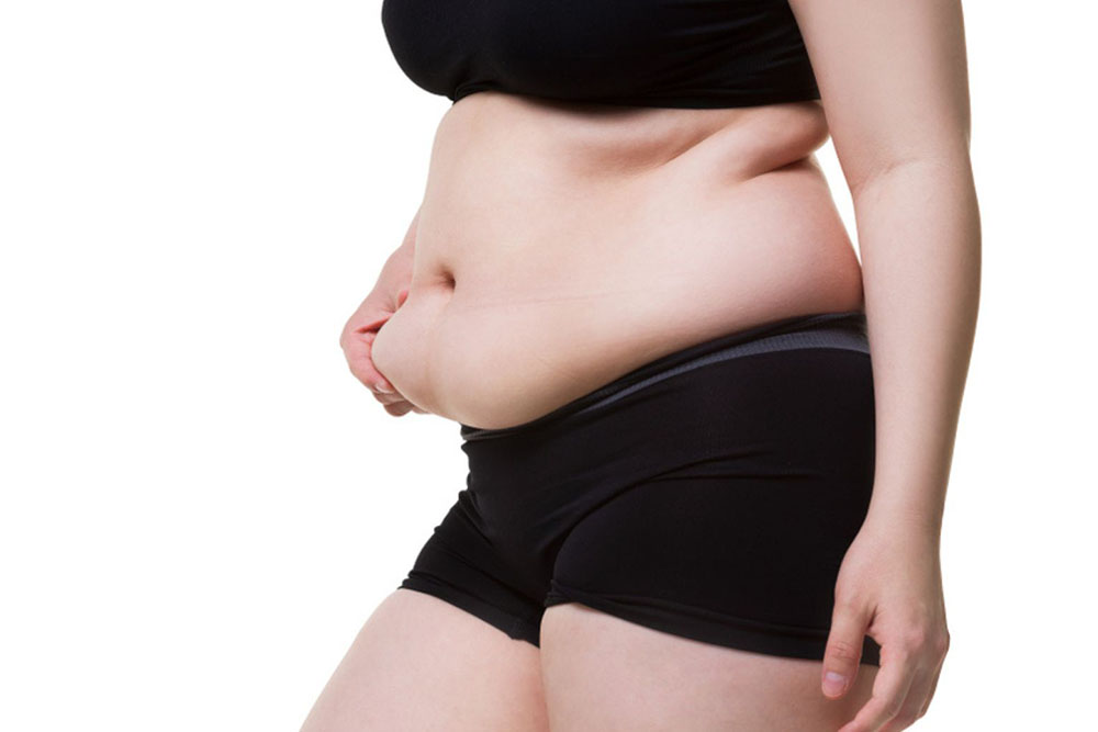 Abdominoplasty can improve core strength, posture, and confidence