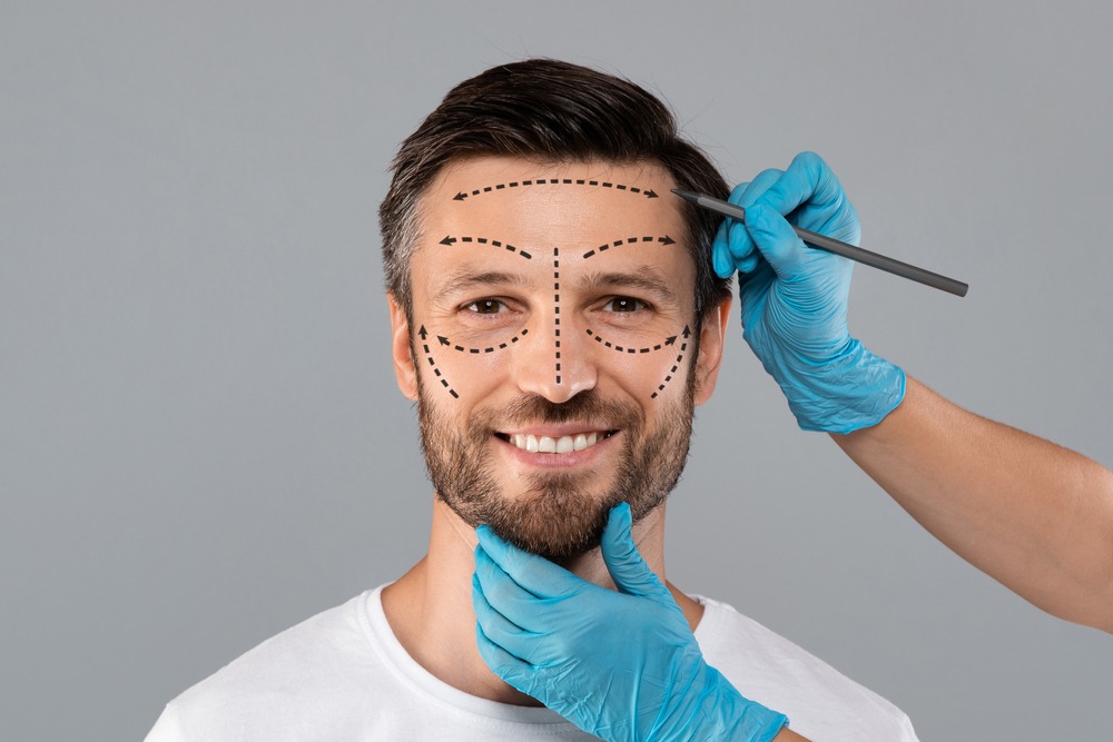 A variety of men showcasing different facial features for facelift considerations.