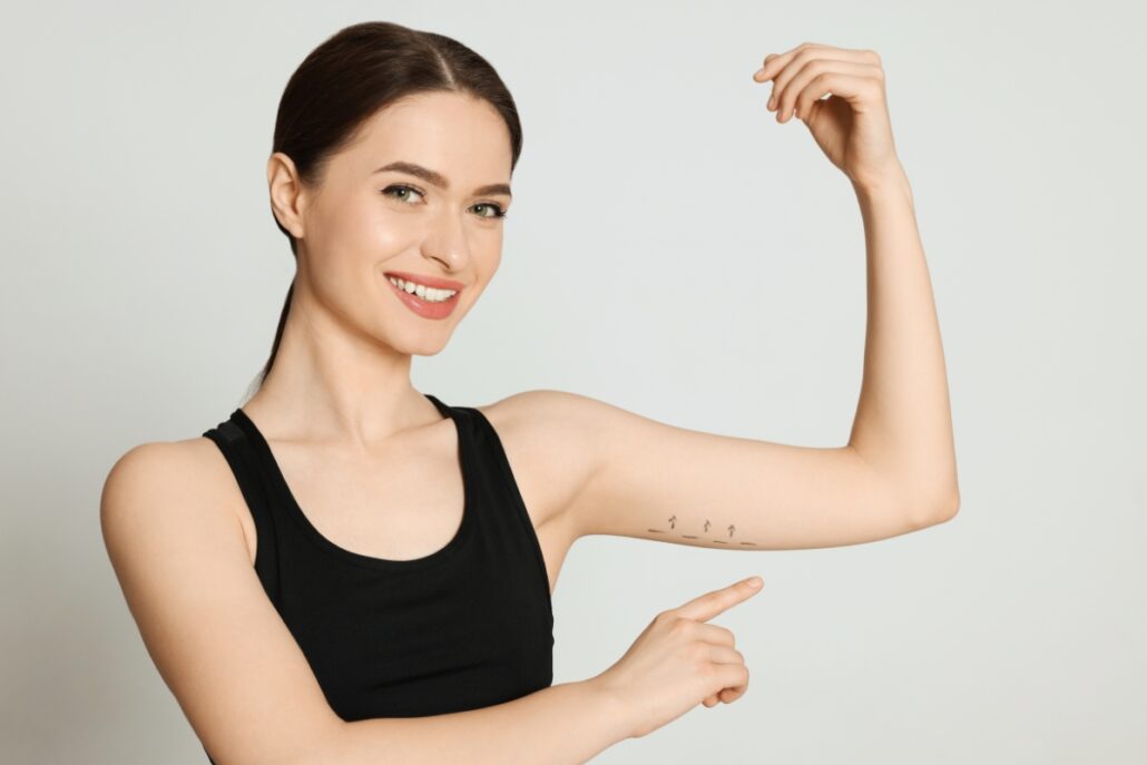 Smiling woman pointing to her arm, highlighting potential areas for an arm lift procedure for sagging skin correction.